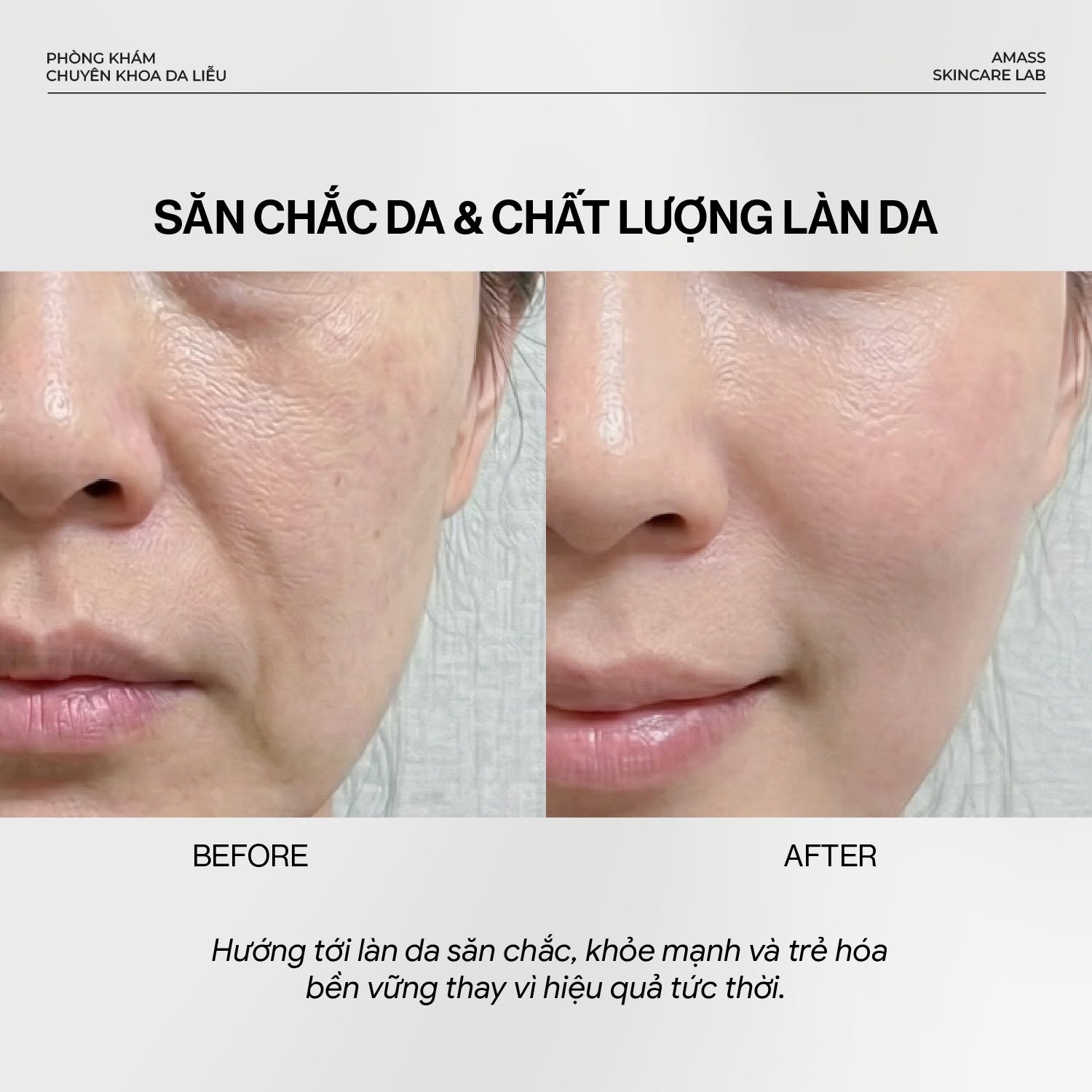 Công nghệ trẻ hóa toàn diện đa tầng tại Amass Skincare Lab